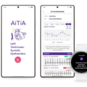 Samsung is working on wearables with early detection tools for heart failure and brain health