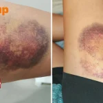 Woman claims bus driver was ‘speeding’ after sudden stop left her bruised, Go-Ahead says he drove within limit