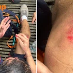 Elderly man taken to hospital after falling along Windsor Nature Park trail, NParks finds no defects