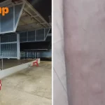 Residents attacked by bed bugs after rough sleeper leaves foldable bed at Ang Mo Kio function stage