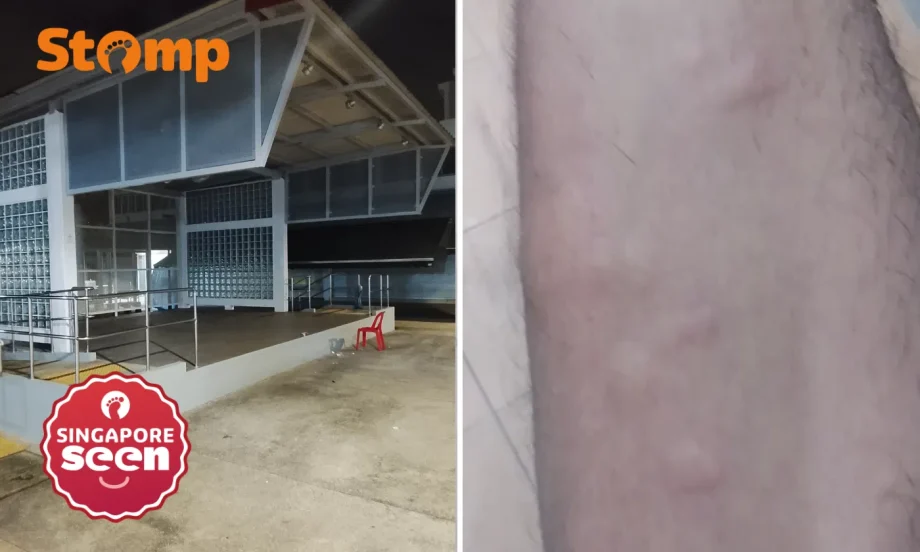 Residents attacked by bed bugs after rough sleeper leaves foldable bed at Ang Mo Kio function stage