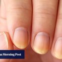 What do nails say about your health? Experts reveal what to look for and how to fix issues