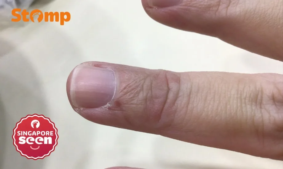 Woman opens car door in Queenstown, hits pedestrian and injures his finger Woman opens car door in Queenstown, hits pedestrian and injures his finger