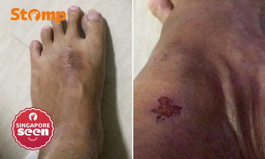 Man’s foot ‘crushed’ by kids on joyride at Queenstown Christmas event