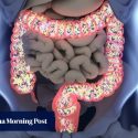 Why your gut microbiome is so important for health and how to protect it