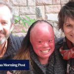 Parents of Hong Kongâs âGirl Behind the Faceâ share their story for the first time Parents of Hong Kongâs âGirl Behind the Faceâ share their story for the first time