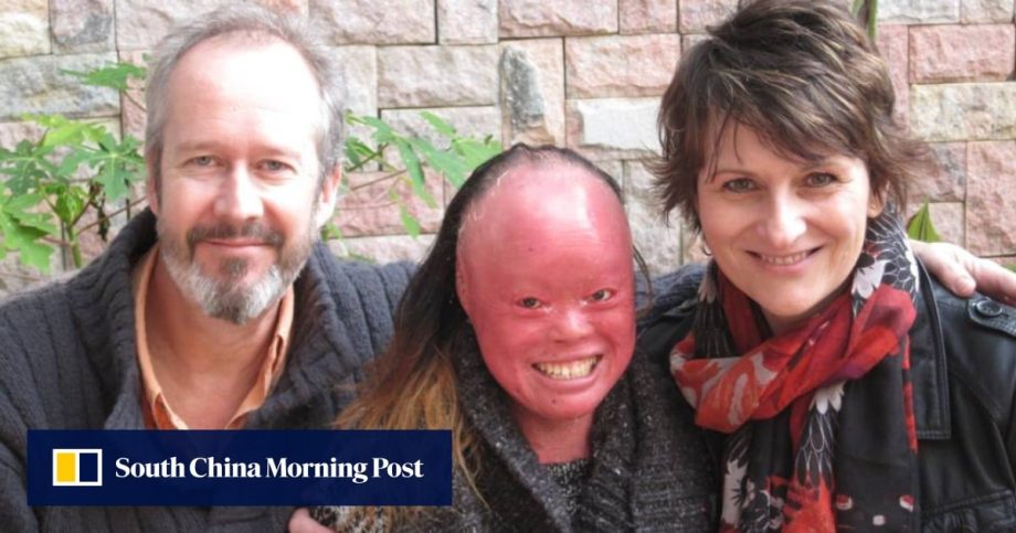 Parents of Hong Kong’s ‘Girl Behind the Face’ share their story for the first time