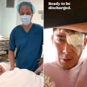 Actor Elvin Ng undergoes emergency retinal surgery after noting dark circular shadow in eye
