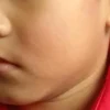 Man arrested for allegedly slapping 4-year-old boy outside Woodlands pre-school