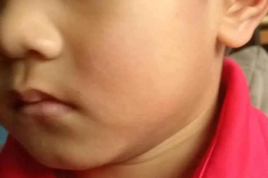 Man arrested for allegedly slapping 4-year-old boy outside Woodlands pre-school