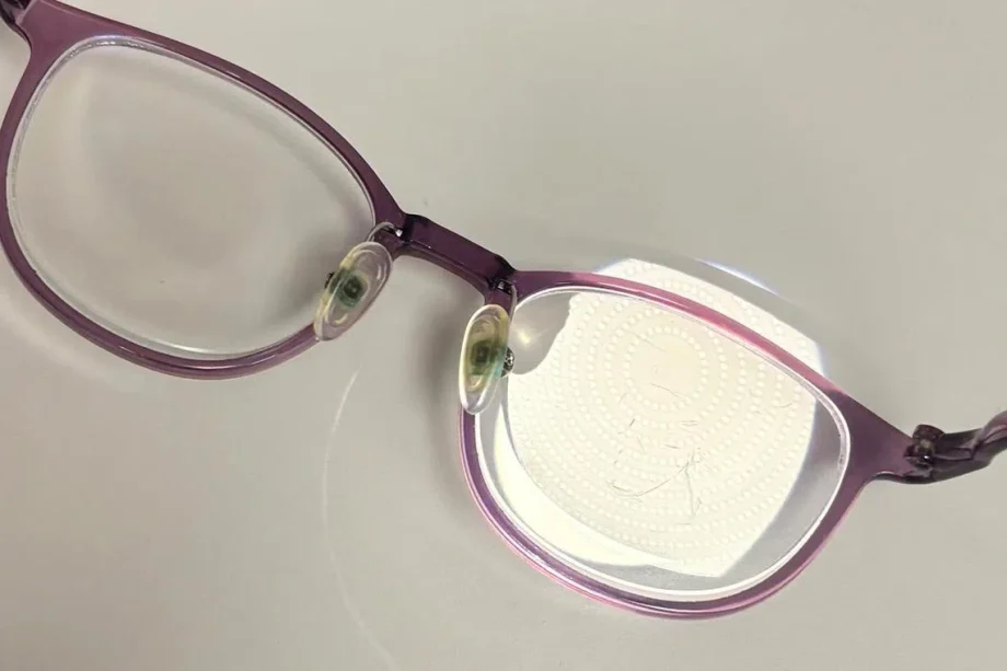 More younger adults in Singapore developing glaucoma, likely because of untreated myopia