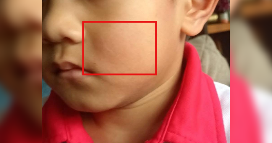 4-year-old boy allegedly slapped twice by man outside Woodlands preschool, police report lodged, Singapore News