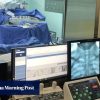 Chinese surgery robot outperforms humans, cuts brain imaging time by 29%