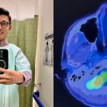 4 years post-cancer: Baey Yam Keng relieved ‘everything is clear’ after discovering abnormality on nose , Singapore News