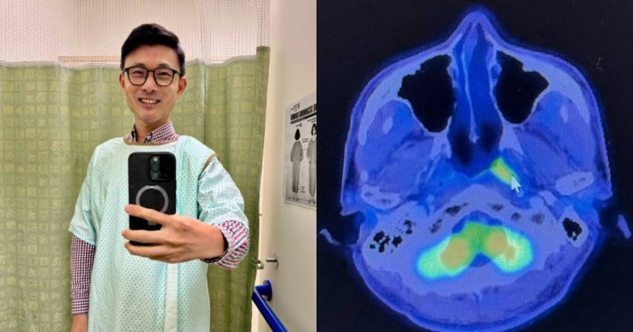 4 years post-cancer: Baey Yam Keng relieved ‘everything is clear’ after discovering abnormality on nose , Singapore News 4 years post-cancer: Baey Yam Keng relieved ‘everything is clear’ after discovering abnormality on nose , Singapore News