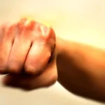 18 months’ probation for teen who assaulted cop, causing nose fracture