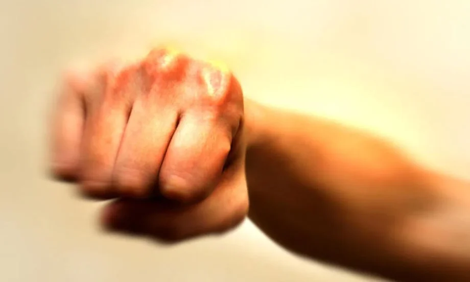 18 months’ probation for teen who assaulted cop, causing nose fracture