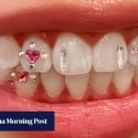 Inside Hong Kong’s tooth gem trend as fans add sparkle to their smiles