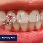 Inside Hong Kong’s tooth gem trend as fans add sparkle to their smiles