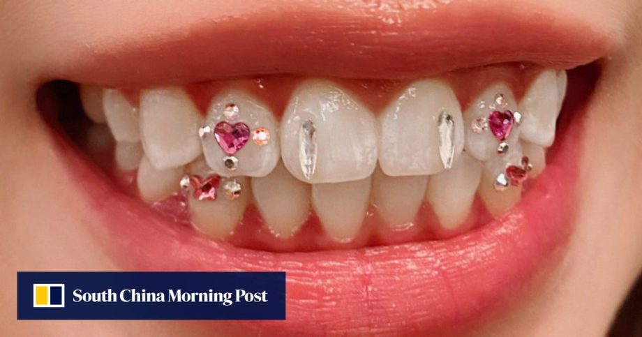 Inside Hong Kong’s tooth gem trend as fans add sparkle to their smiles