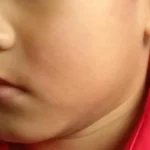 Man to be charged after allegedly slapping 4-year-old boy outside Woodlands pre-school