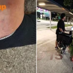 Stomper’s foot oozes blood after allegedly being hit by PMD in Yishun, police investigating