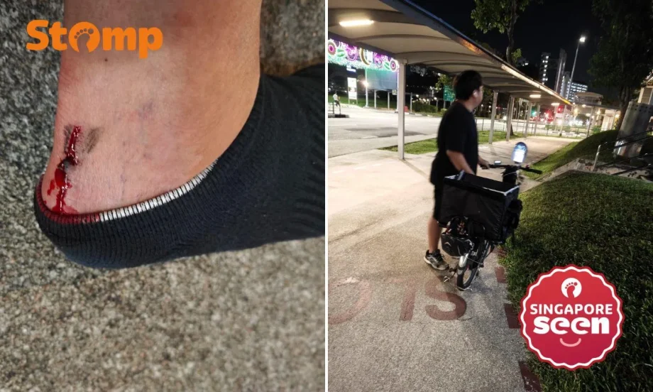 Stomper’s foot oozes blood after allegedly being hit by PMD in Yishun, police investigating