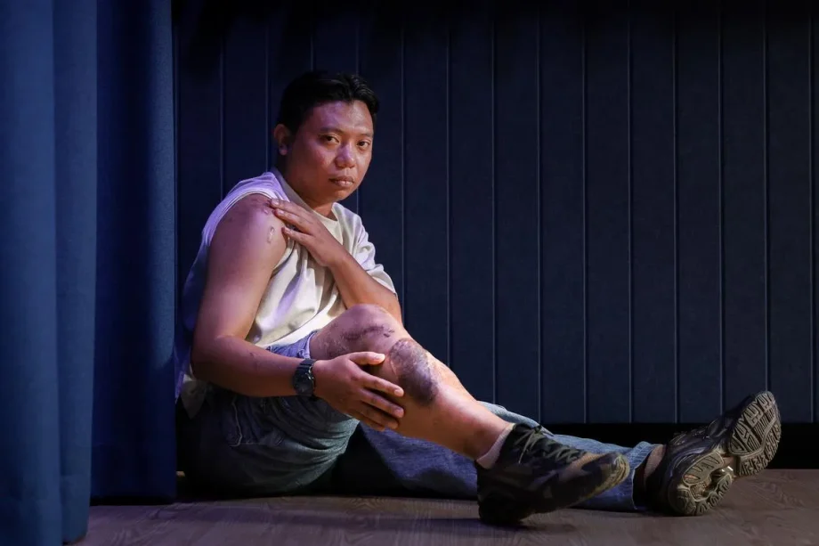 Tampines crash: Motorcyclist’s life-altering injuries