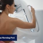 Who should get a mammogram and how often. 4 things to know about breast cancer screening