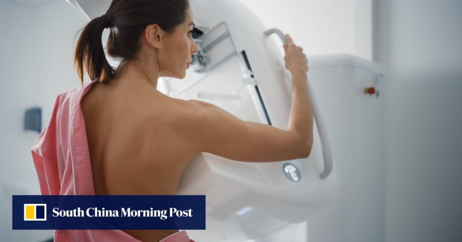 Who should get a mammogram and how often. 4 things to know about breast cancer screening Who should get a mammogram and how often. 4 things to know about breast cancer screening