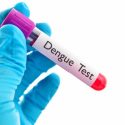 Singapore reports steep decline in dengue cases