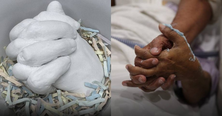 ICU patients and families create hand sculptures as ‘lasting symbol of togetherness’ at Tan Tock Seng Hospital, Singapore News
