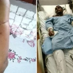 Five minutes later to hospital, Jurong traffic accident victim might not have survived Five minutes later to hospital, Jurong traffic accident victim might not have survived
