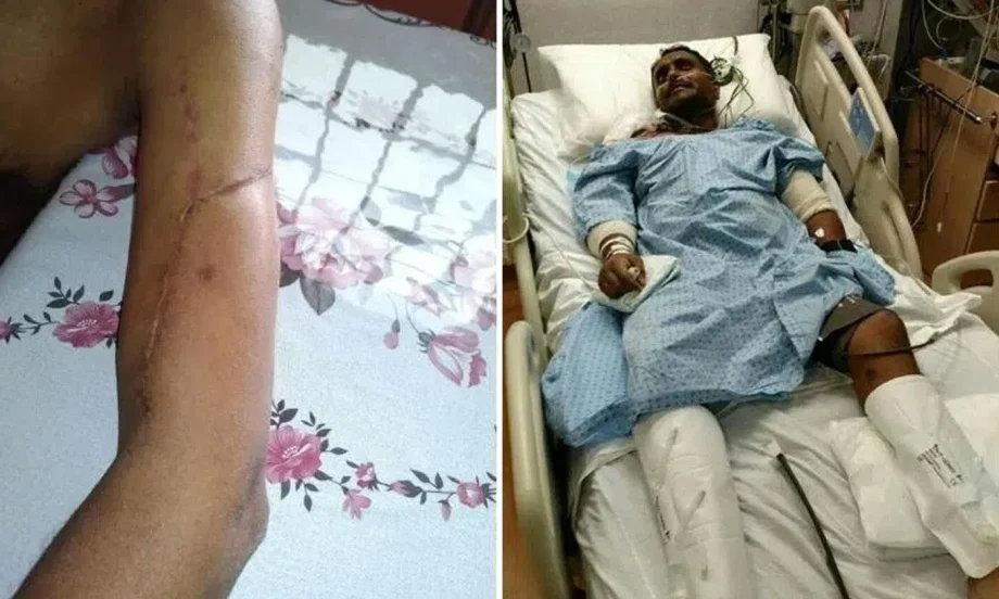 Five minutes later to hospital, Jurong traffic accident victim might not have survived