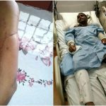 Five minutes later to hospital, Jurong traffic accident victim might not have survived