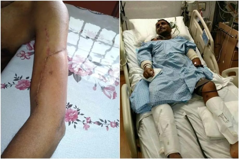 Five minutes later to hospital, Jurong traffic accident victim might not have survived
