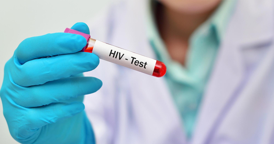 New HIV cases declining in Singapore; CDA urges adults to get tested at least once, Singapore News