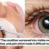 Customer allegedly suffered possible chemical burn after lash extension session at beauty salon in Tai Seng