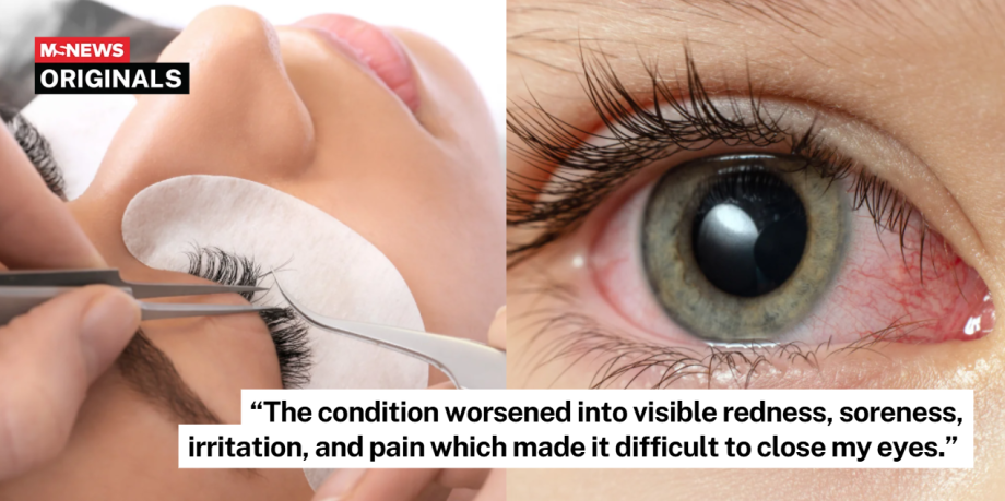 Customer allegedly suffered possible chemical burn after lash extension session at beauty salon in Tai Seng Customer allegedly suffered possible chemical burn after lash extension session at beauty salon in Tai Seng