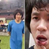 Amos Yee rates Suntec assault 4 or 5 out of 10
