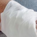 Doctor suspended after diabetic patient with infected foot had leg amputated