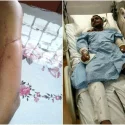‘I wondered when it’d be my turn’: Jurong traffic accident victim who heard others flatlining in ICU