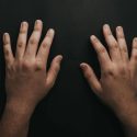 Does Handedness Affect Accidents at Work?