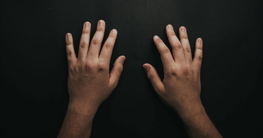 Does Handedness Affect Accidents at Work?