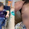 Singaporean boy suffers concussion, eye socket fracture after alleged buggy collision at Incheon Airport, Singapore News