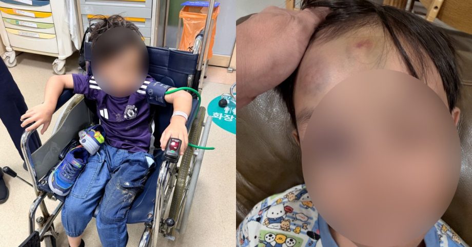 Singaporean boy suffers concussion, eye socket fracture after alleged buggy collision at Incheon Airport, Singapore News