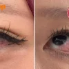 Woman suffers eye pain after lash service