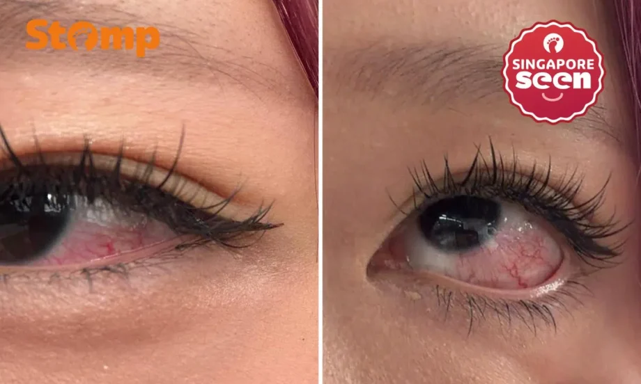 Woman suffers eye pain after lash service Woman suffers eye pain after lash service