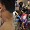 Orchard Road stabbing: Victim recounts knife attack