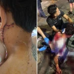 Orchard Road stabbing: Victim recounts knife attack